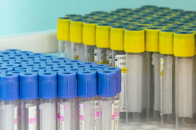 В медучреждения Москвы поставили 100 тыс экспресс-тестов на иммунитет к COVID-19. Фото: сайт мэра Москвы