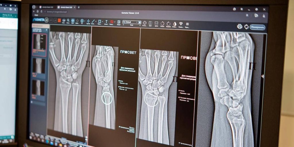 Столичным врачам стали доступны два новых ИИ-сервиса для диагностики травм суставов